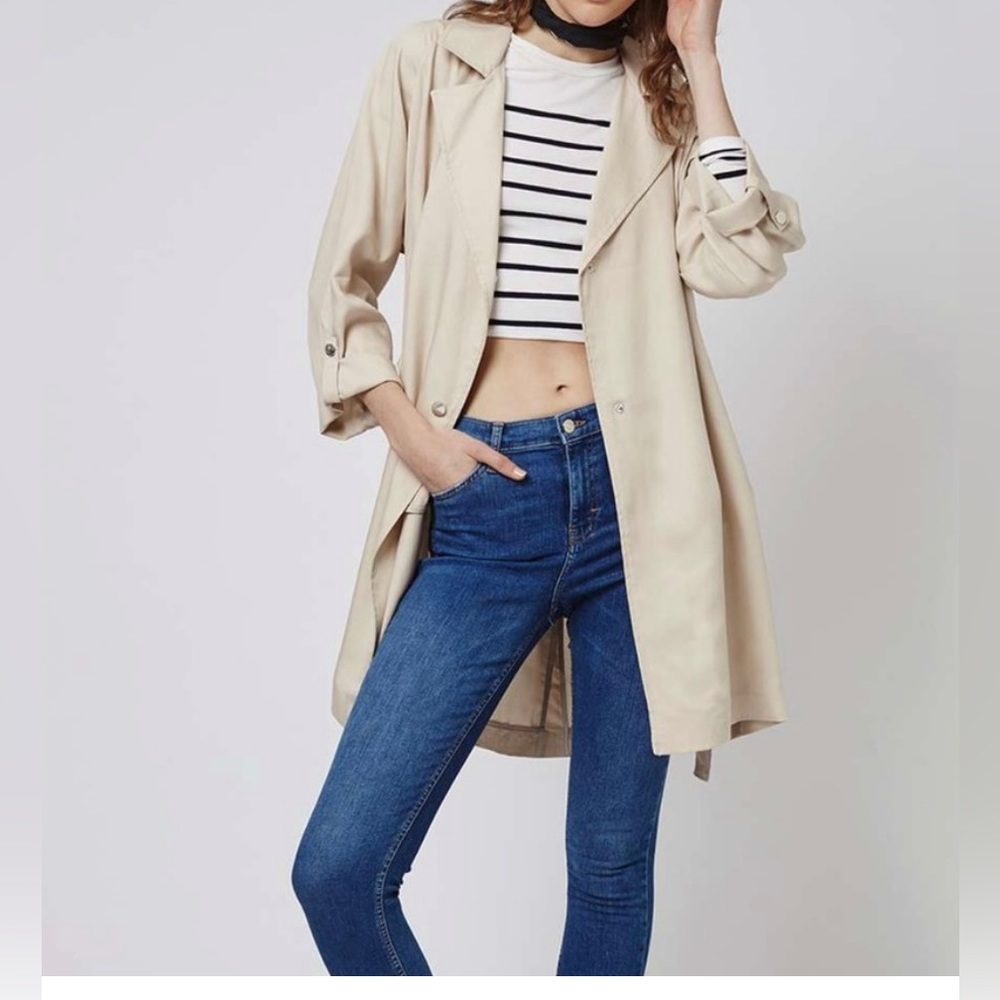 NWT Topshop trench coat